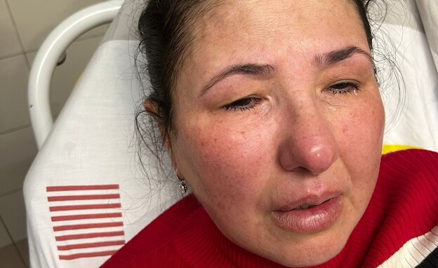 ספגה גז פלפל מכרטיסן (צילום: באדיבות המצולמת)