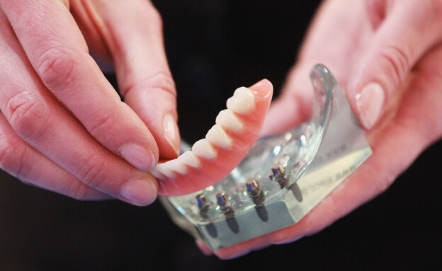 שיניים תותבות (צילום: Joern Pollex , getty images)