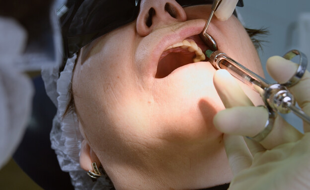 ניתוח שיניים (צילום: שאטרסטוק)