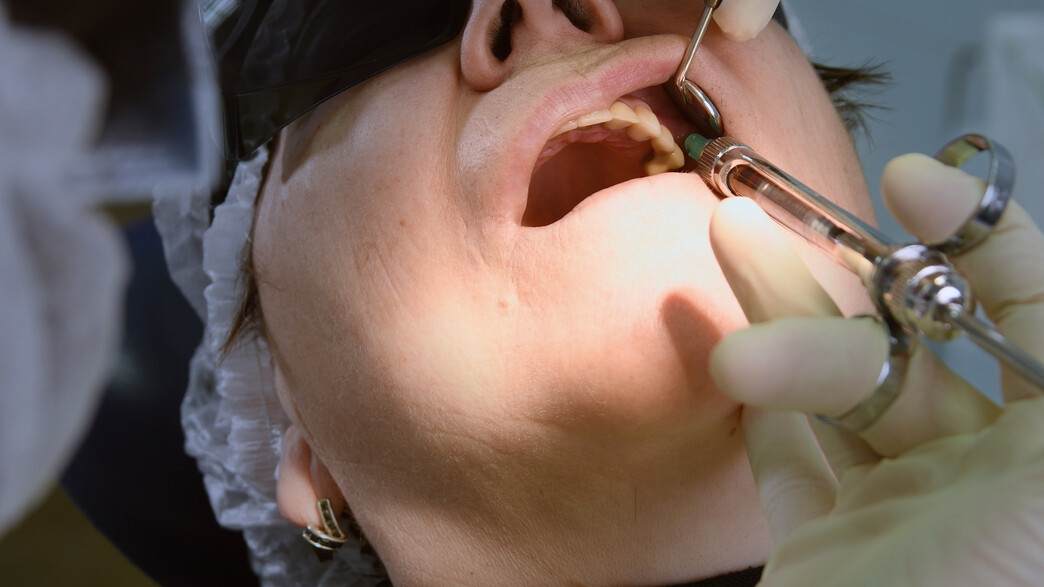 ניתוח שיניים (צילום: שאטרסטוק)