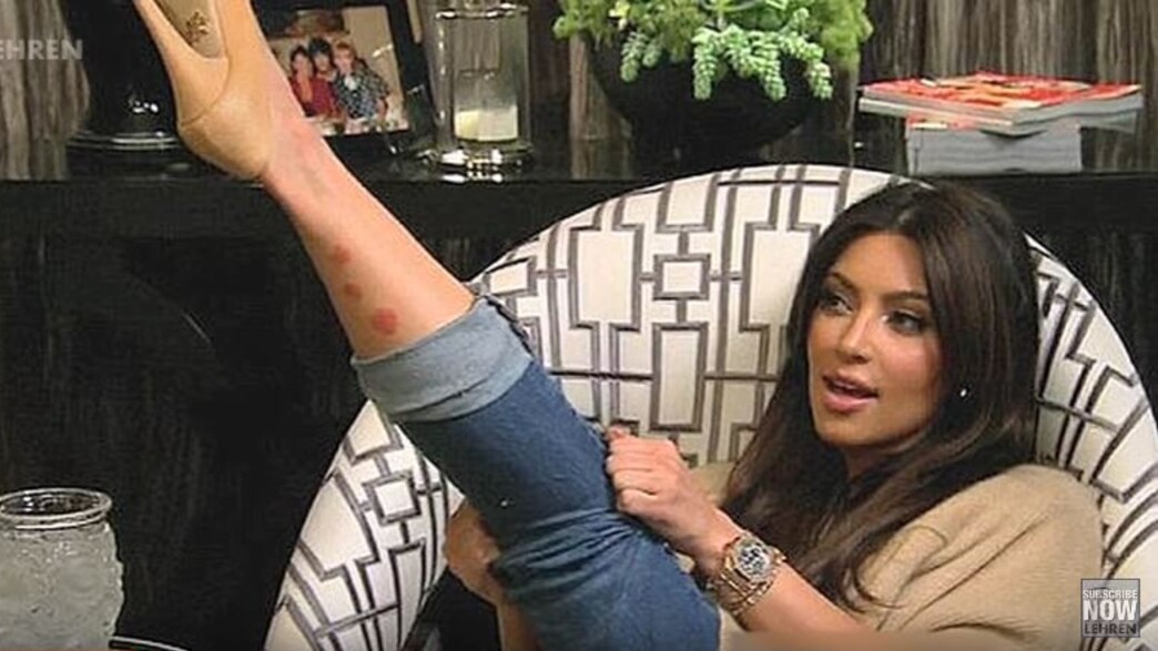 קים פסוריאזיס קים פסוריאזיס