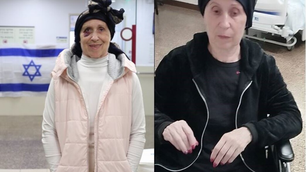 טטאינה לפני ואחרי הניתוח (צילום: איתי דגן )
