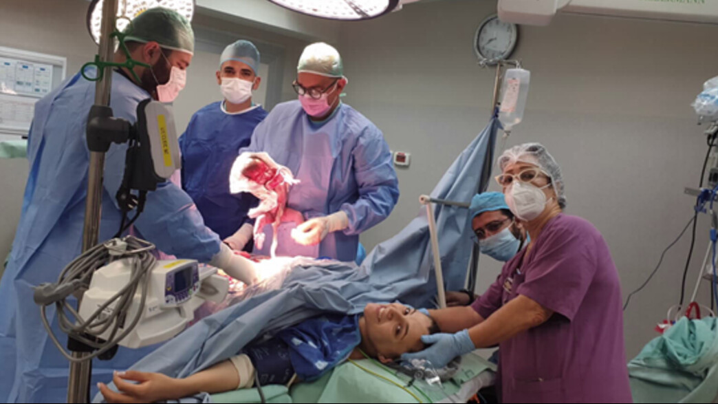 ד"ר מיקי מוסקוביץ במהלך ניתוח קיסרי צרפתי (צילום: דוברות שמיר)