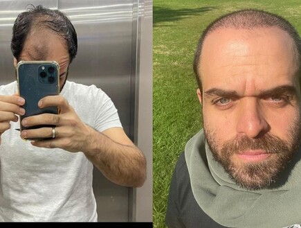 אבי לפני ואחרי (צילום: איתי דגן )