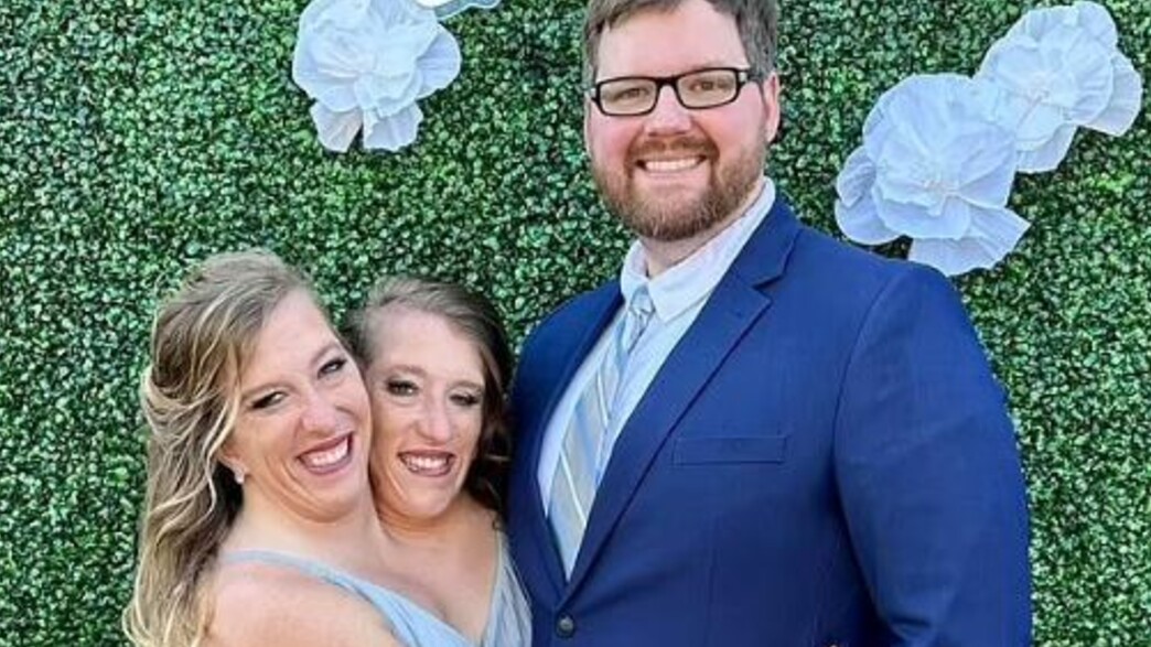 אבי ובריטני הנזל התאומות הסיאמיות