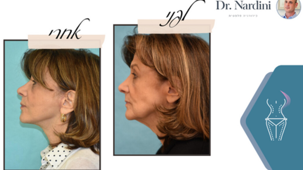 מרפאת גיל נרדיני מרפאת גיל נרדיני