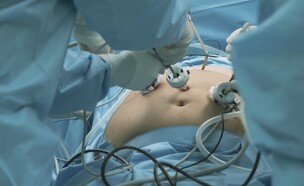 ניתוח בריאטרי (צילום: shutterstock_Pongsatorn Korbua)
