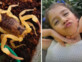 ברזיל: בת 5 מתה אחרי שנעקצה על ידי העקרב המסוכן ביותר באמריקה הדרומית