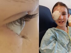הנערה במחלקת עיניים (צילום: מרכז רפואי מאיר)