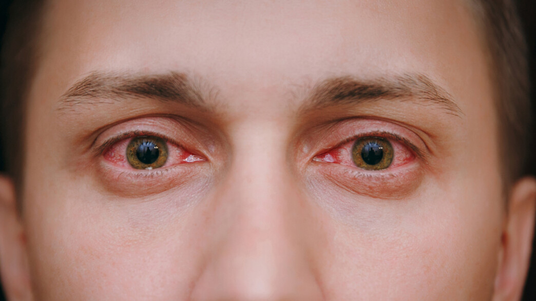 עיניים (צילום: SHUTTERSTOCK)