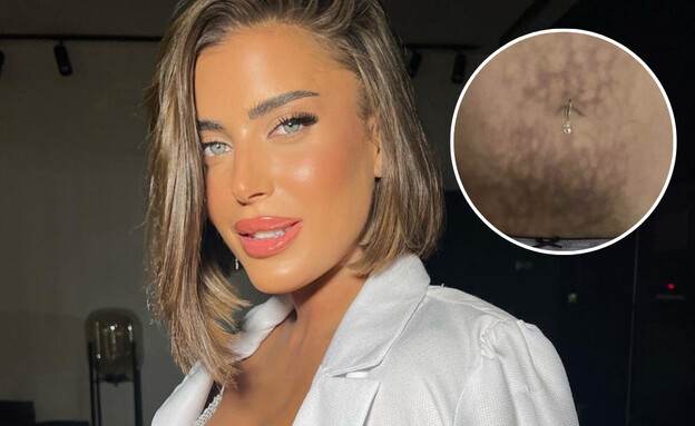 ספיר בורגיל על הצלקות בבטן (צילום: instagram)