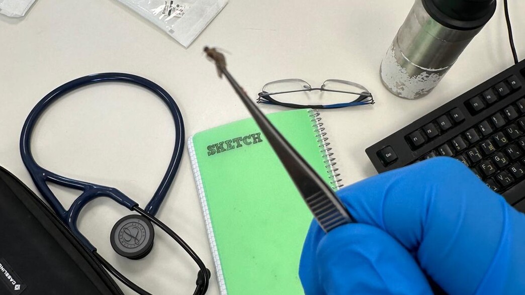 חרק חי שנמצא באוזנה של נאוה סלע