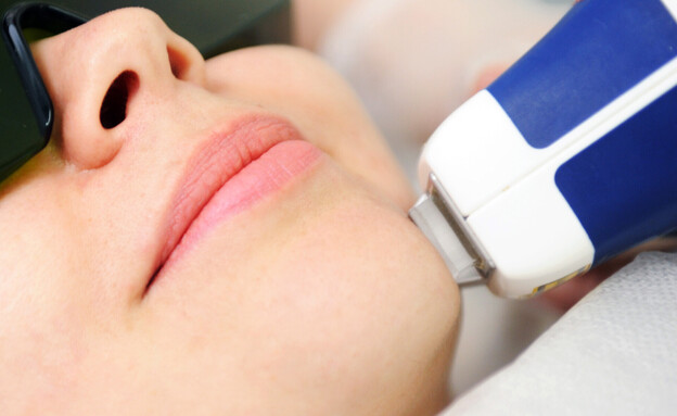 הסרת שיער בלייזר, אילוסטרציה הסרת שיער בלייזר, אילוסטרציה