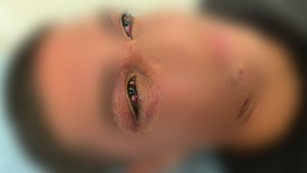 הנער שנפגע בגלל אתגר טיקטוק