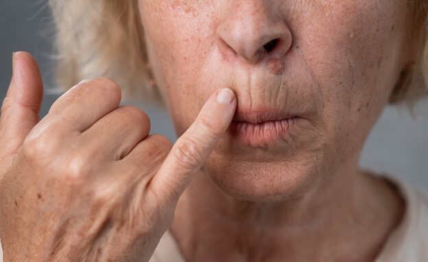 קמטים מסביב לשפתיים (צילום: shutterstock)