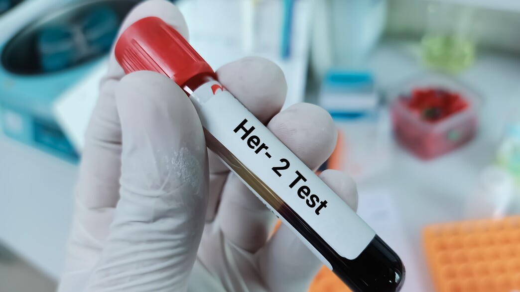 סרטן שד מבחנה