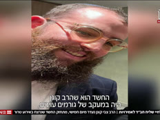 20chabad_vtr2_n20241123_v1 (צילום: חדשות)