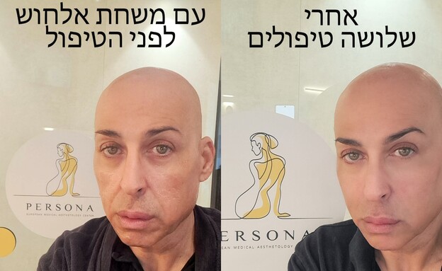 מיקי אגי (צילום: באדיבות המצולם, פרטי)