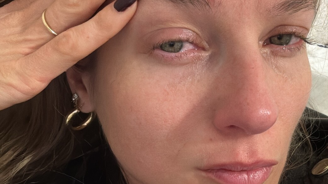 עדי הימלבלוי