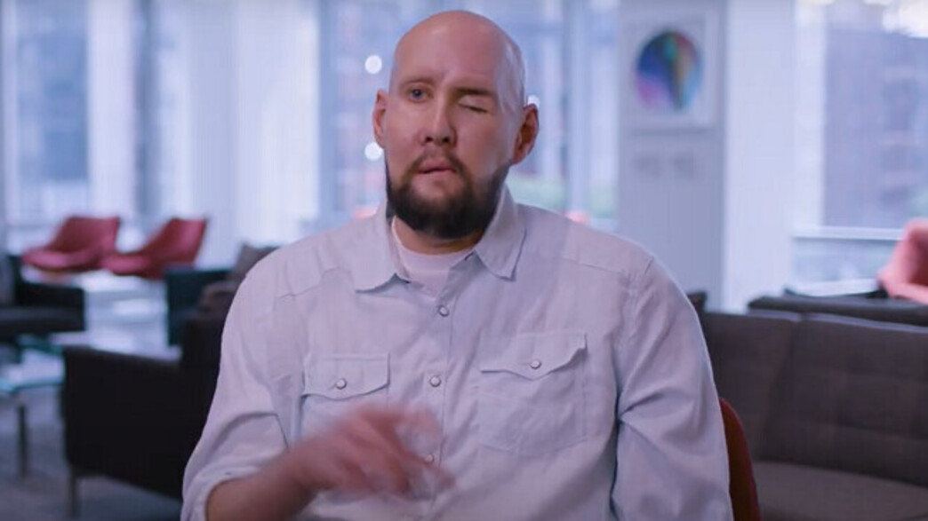 ארון ג'יימס, מושתל העין הראשונה ארון ג'יימס, מושתל העין הראשונה