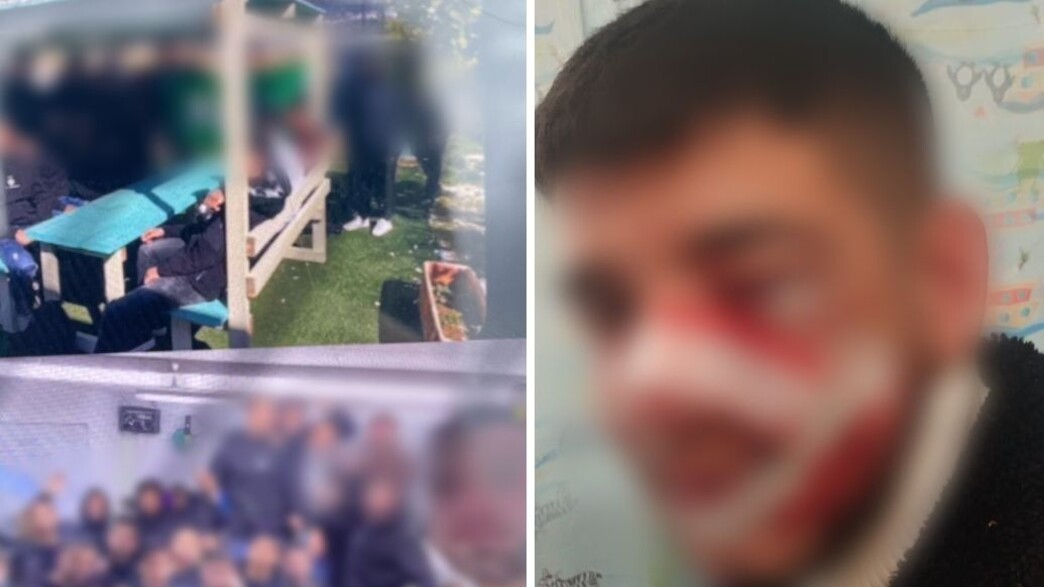 תלמיד תיכון במע'אר שנפצע בקטטה