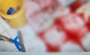 זירת ניסיון הרצח בתל אביב