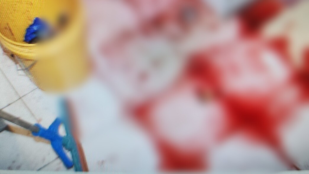 זירת ניסיון הרצח בתל אביב זירת ניסיון הרצח בתל אביב