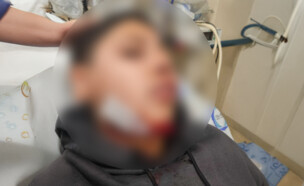 ילד נפצע כתוצאה מאלימות בבית הספר (צילום: באדיבות הורי המצולמים)