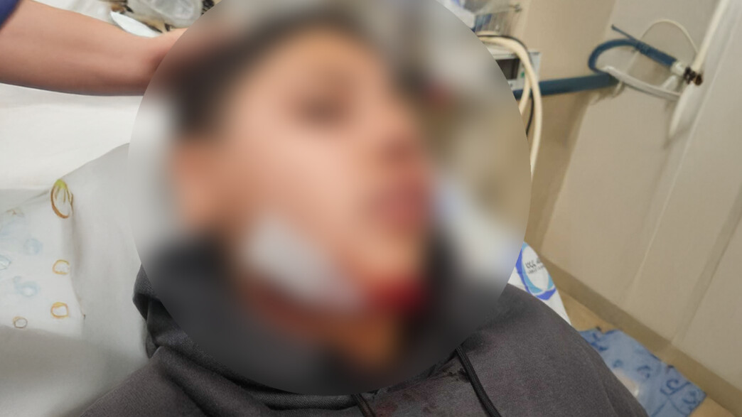 ילד נפצע כתוצאה מאלימות בבית הספר