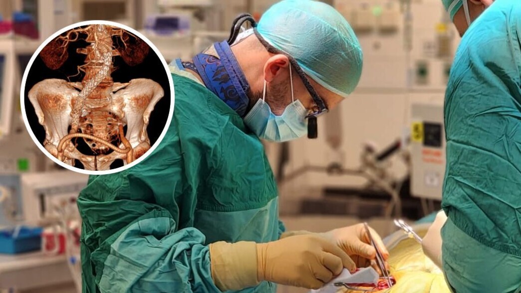 מפרצת בלינסון