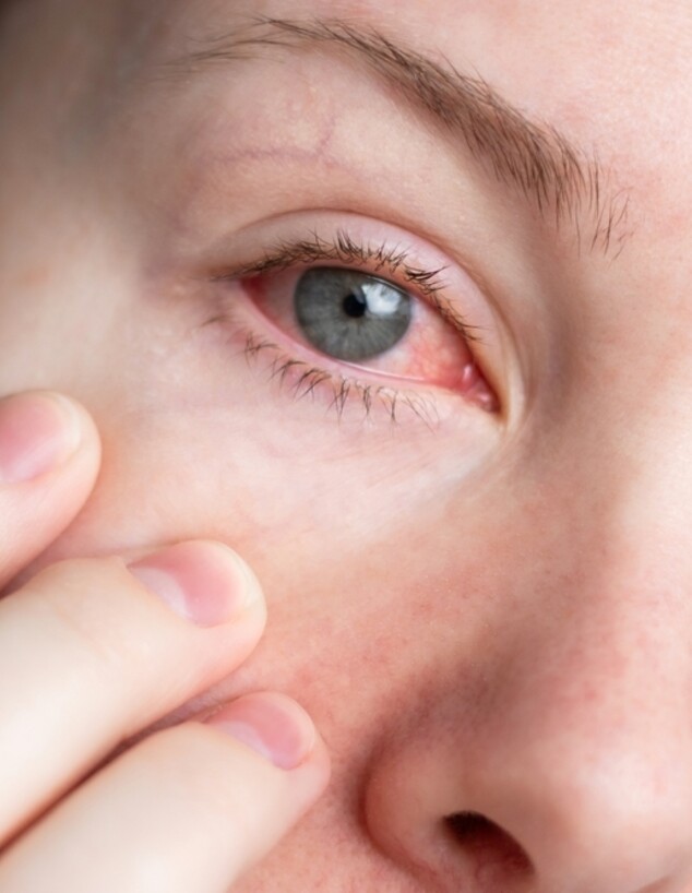 עין אדומה, גוף זר בעין