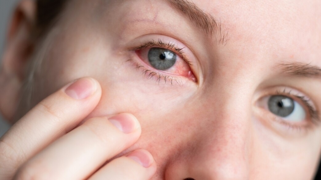 עין אדומה, גוף זר בעין עין אדומה, גוף זר בעין