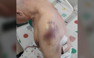 חריסטו ז'לב, שנדקר ברחוב בראשון לציון