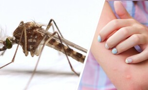 עקיצת יתוש (צילום: shutterstock_aslysun)