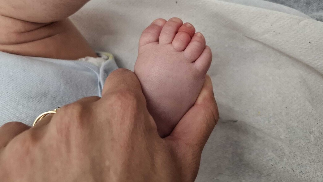 שערה התלפפה סביב אצבעו של התינוק