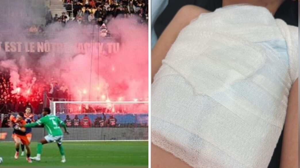 הילד שנפגע מאבוקה