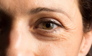 עיניים קלוז אפ, עיגולים שחורים סביב העיניים (צילום: shutterstock_sruilk)