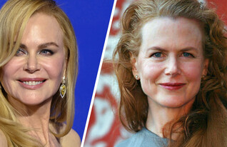 שינויים ניקול קידמן