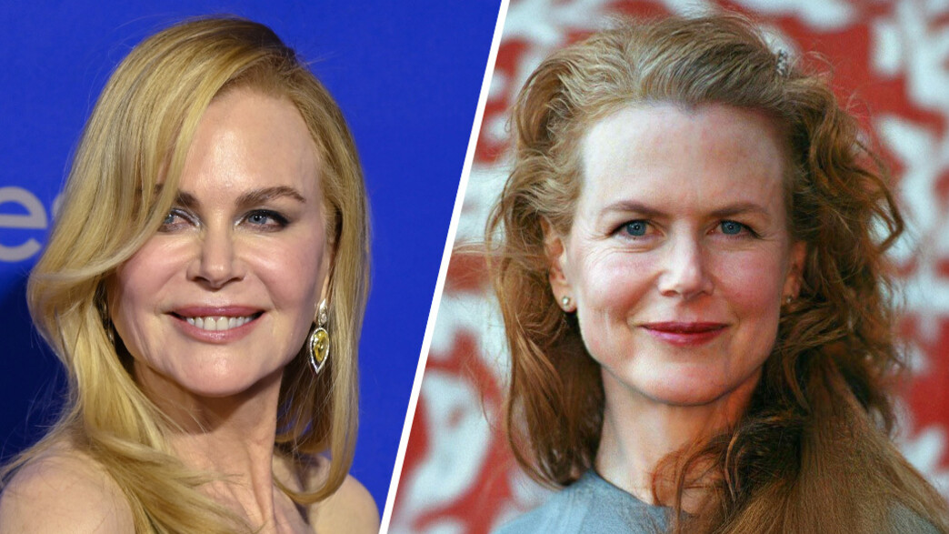 שינויים ניקול קידמן