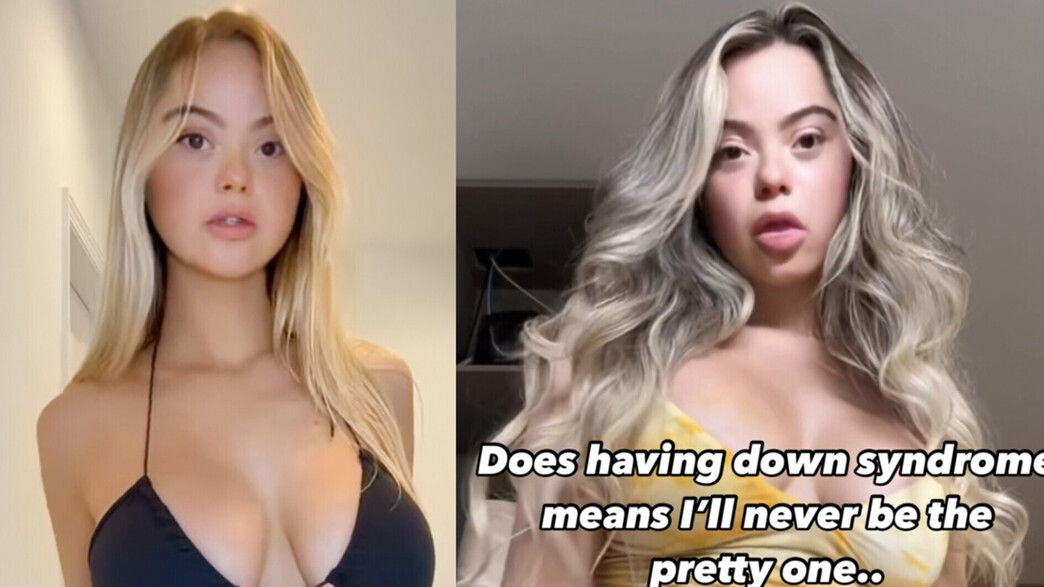 פילטר תסמונת דאון פילטר תסמונת דאון