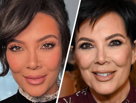 "מתיחת הפנים של קריס ג’נר כבר מתחילה לצנוח. היא נואשת"