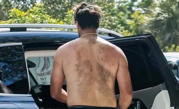 טראוויס קלסי  (צילום: רשתות חברתיות, לפי חוק 27א׳ לזכויות יוצרים)