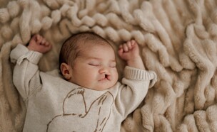 שפה שסועה (צילום: shutterstock)