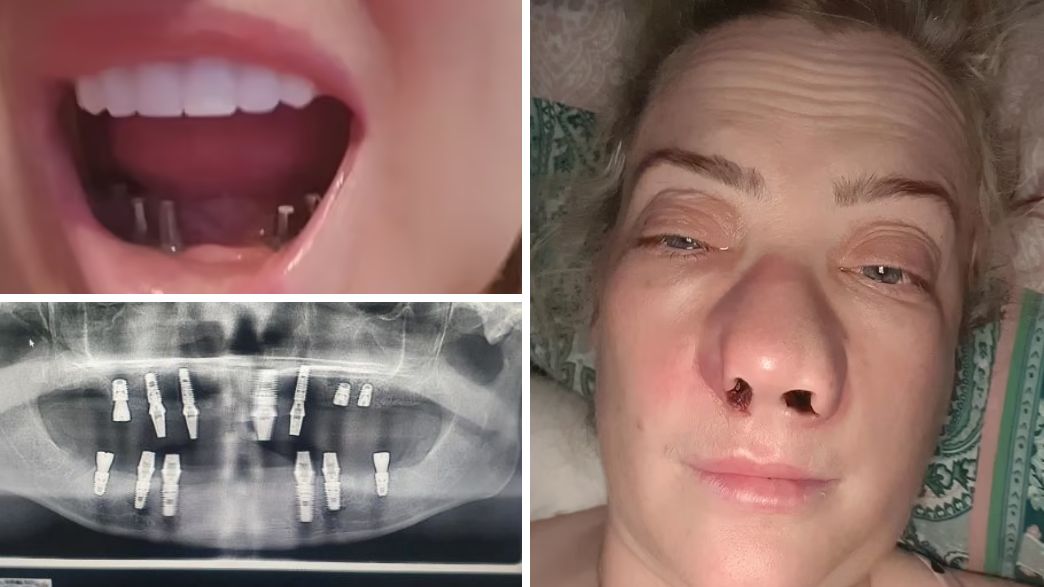 לין טלפורד לין טלפורד