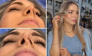 איזבלה לאקס (צילום: מתוך הרשתות החברתיות בהתאם לסעיף 27א' בחוק)