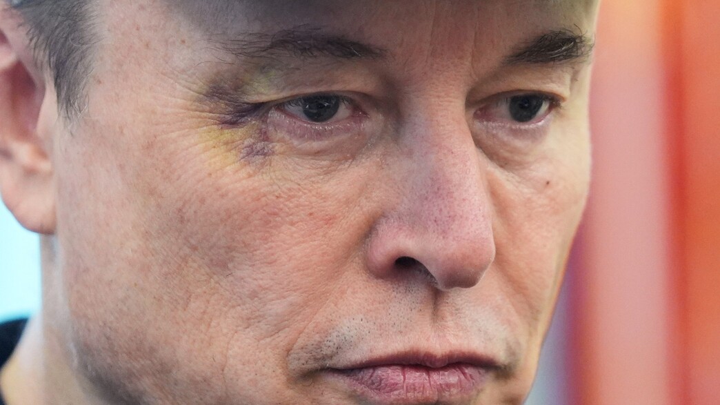 אילון מאסק הופיע בבית הלבן עם פנס בעין