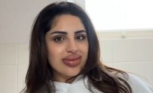 מילוי שפתיים שהשתבש (צילום: טיקטוק)