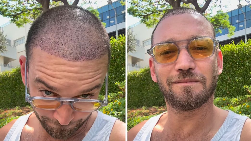 דין מירושניקוב