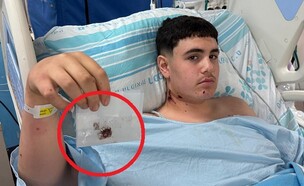 איתי מייסון (צילום: דוברות רמב"ם)