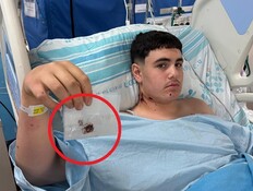 איתי מייסון (צילום: דוברות רמב"ם)